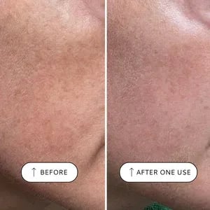 VOTARY Sensitive Resurfacing Peel - 10% Ácido Lacid y Super Seeds