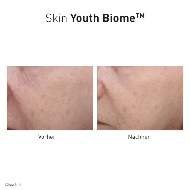 ANP Skin Youth Biome 60 unidades. Suplemento alimenticio