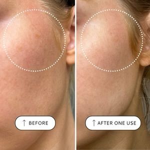 VOTARY Sensitive Resurfacing Peel - 10% Ácido Lacid y Super Seeds