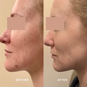 VOTARY Super Barrier Balm Cica y Probiotic